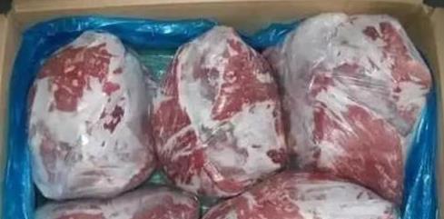 女子吃冷冻肉后头疼欲裂确诊脑膜炎